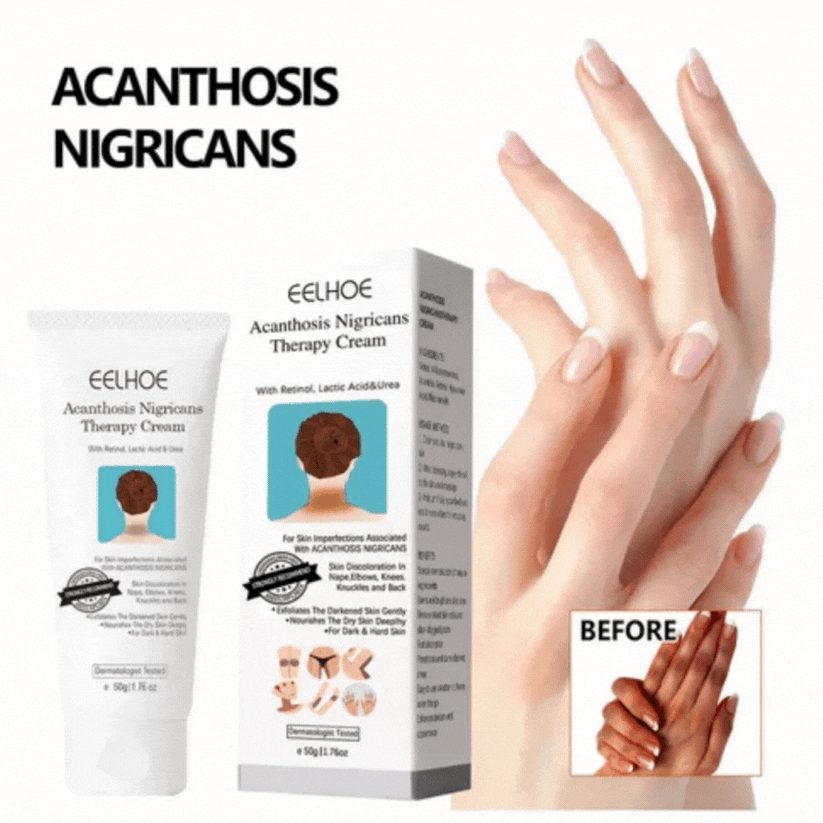 ¡Piel Sin Manchas Oscuras en 3 Semanas! Dermiluce, Ideal para Zonas Íntimas ✅ Aprovecha: llévate 2 pagando solo 1.