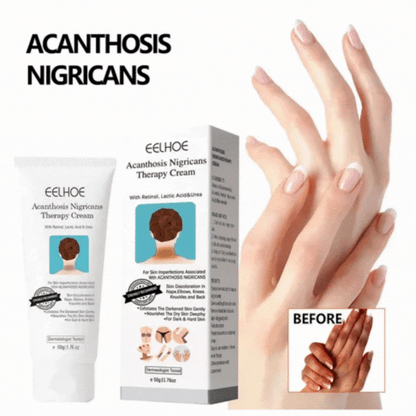 ¡Piel Sin Manchas Oscuras en 3 Semanas! Dermiluce, Ideal para Zonas Íntimas ✅ Aprovecha: llévate 2 pagando solo 1.